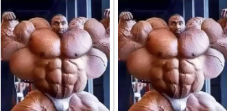 The Side Effects of Synthol: What You Need to Know